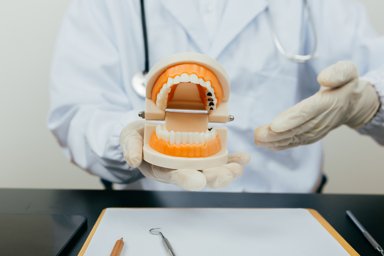 full mouth dental implants procedure